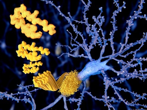 Amyloid Precursor Protein gene (APP)